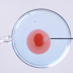 Инвитро: Всичко за асистираната репродуктивна технология
