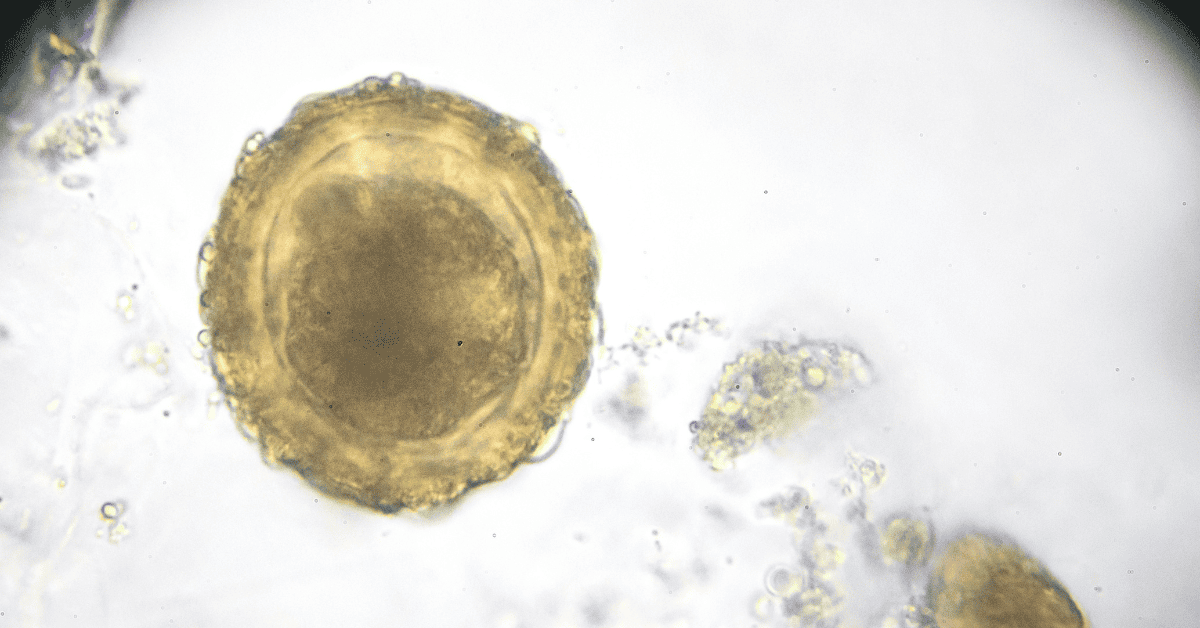Яйцеклетка: Всичко за основната женска полова клетка